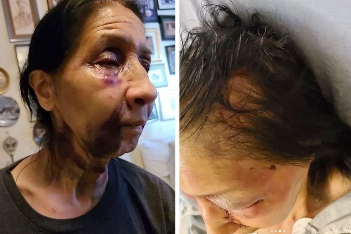 Racista golpea a anciana mexicoamericana